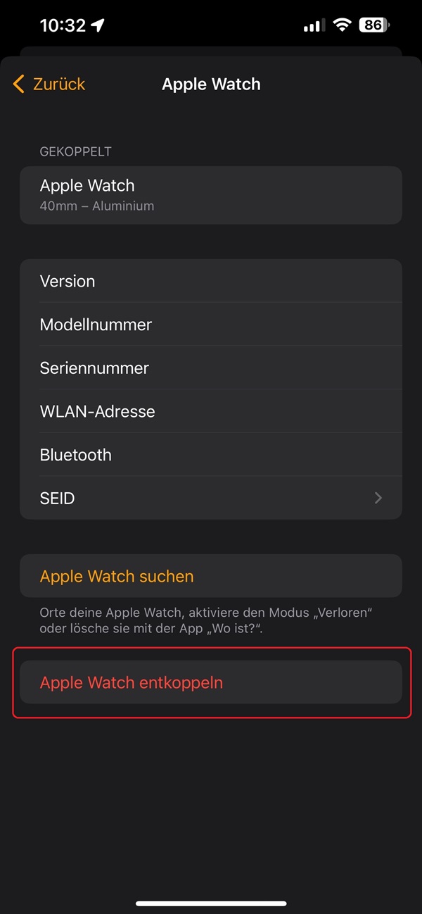Screenshot von der App „Watch“ mit den Auswahlmöglichkeiten für eine gekoppelte Apple Watch.